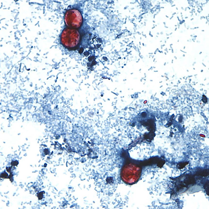 An outbreak of illnesses from the cyclospora parasite has now been connected in nine states.