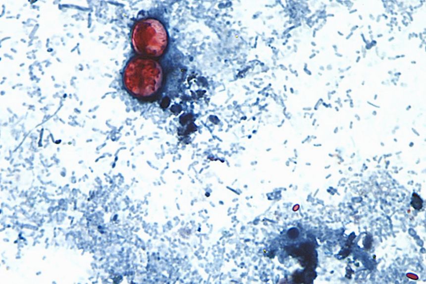 Identifying cyclospora is complicated and can take longer than other pathogens, CDC officials have said.